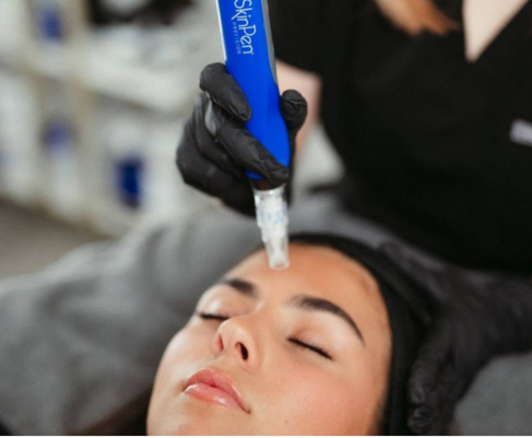 SkinPen Microneedling at Maison Montclair